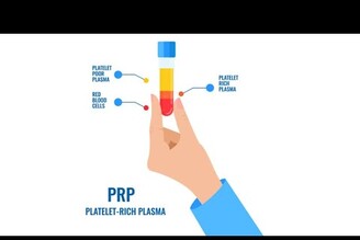 我該打PRP來治療關節炎、運動傷害嗎？PRP自體血小板注射