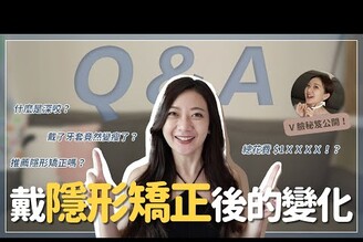 我的牙齒變整齊了嗎？！矯正10個月的變化與心得Q&A