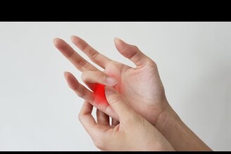 手指好痛！板機指的成因與治療方法