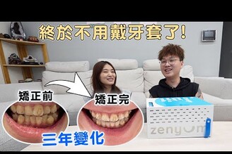 我戴了3年隱形牙套，牙齒從亂到整齊的驚人變化！【Bobo TV】